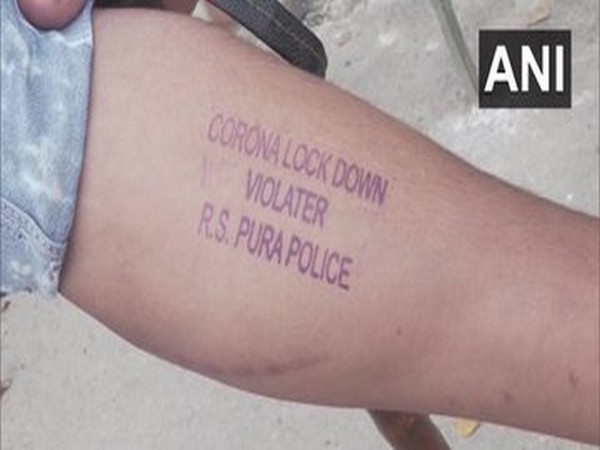Violators of lockdown are being stamped on their hands by the police in RS Pura. Photo/ANI