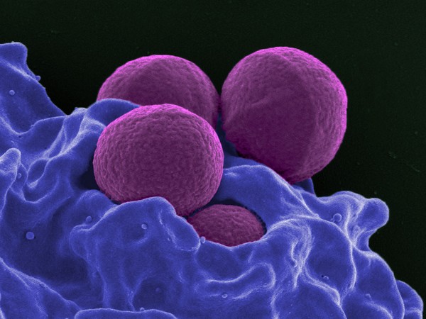 These new antibiotics can block infections caused by the drug-resistant Staphylococcus aureus