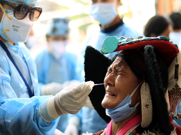 Representative Image