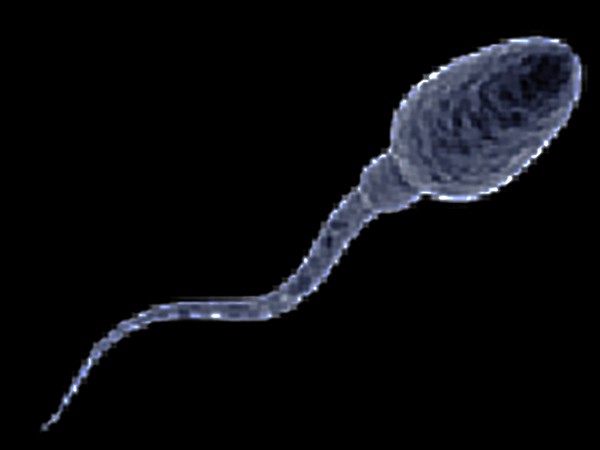 Spermatozoon