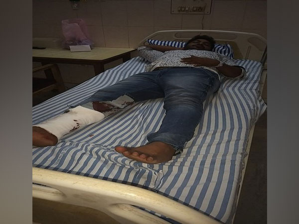 Injured criminal Girish. Photo/ANI