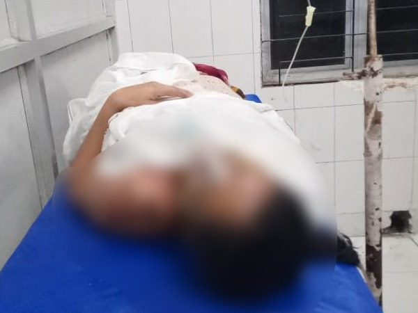 The acid attack victim at Assam Medical College (Photo/ANI)