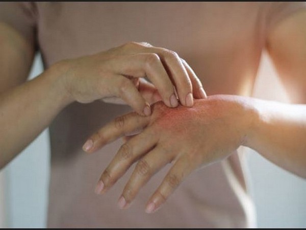 Representative Image