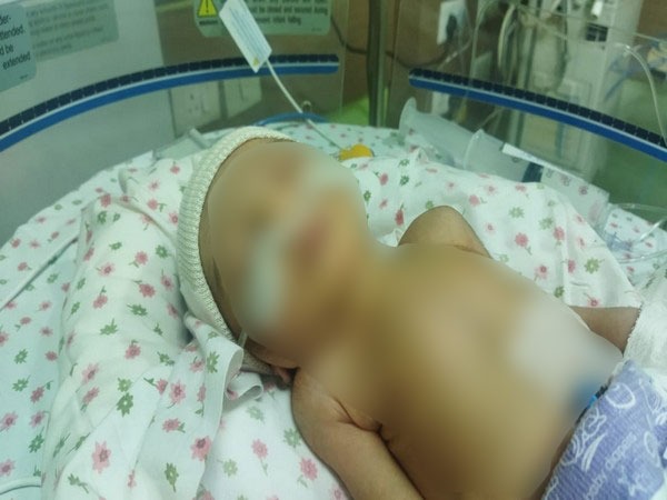 Delhi hospital saves life of 2-day-old abandoned girl child