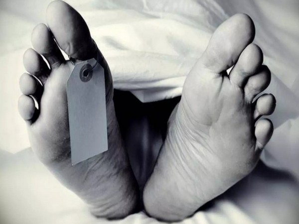 Representative Photo