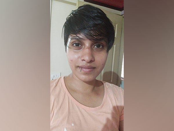 Shraddha Walker with bruises on her face (Photo/ANI)