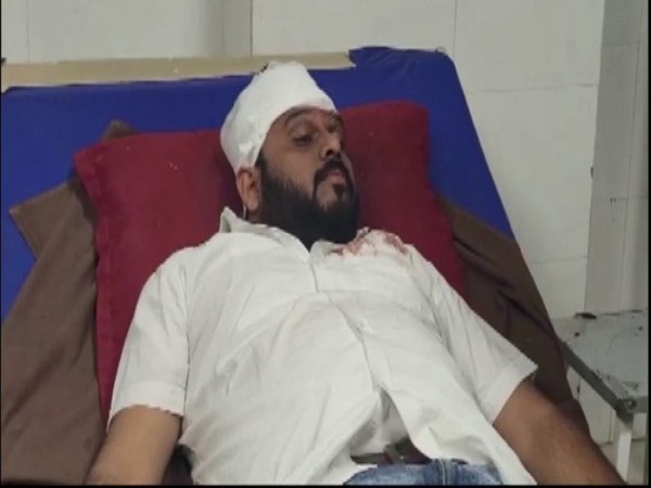 BJP candidate Piyush Patel injured due to attack (Photo/ANI)