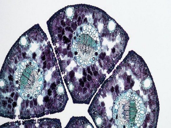 Representative Image (Image Source: Pexels)