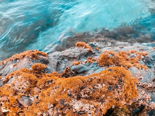 Representative Image (Image Source: Pexels)