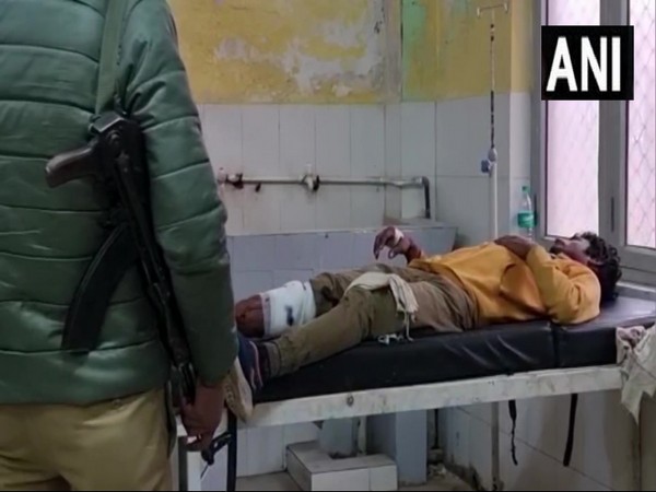 Serial offender injured in encounter in UP's Mathura (Photo:ANI)