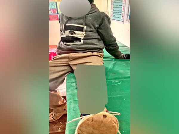 An image of the injured CPI supporter. (Photo credit: Szarita Laitphlang, National Secretary of INC)