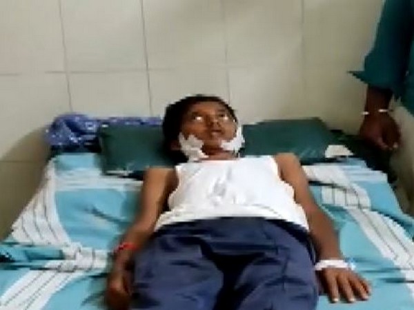 15 year old boy who was attacked by a leopard in Karnataka