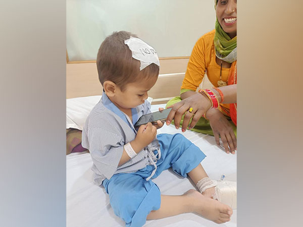 2 year-old-kid after surgery (Photo/ANI)