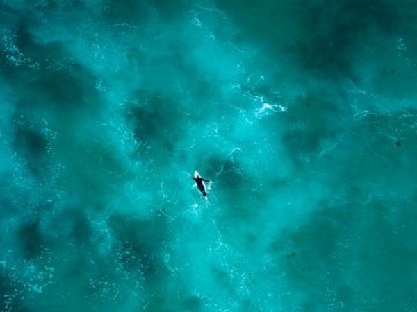 Representative Image. 