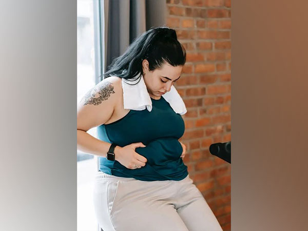 Representative image