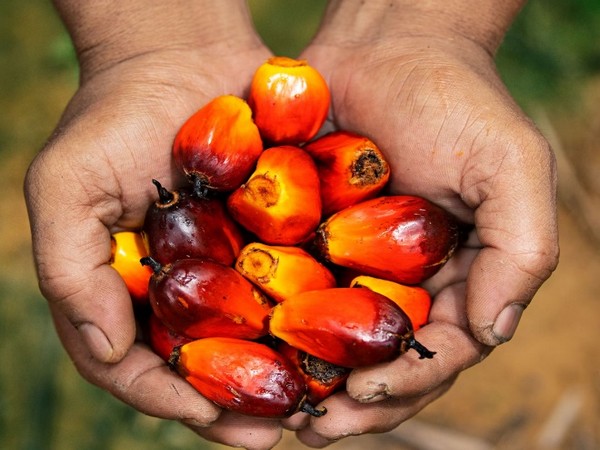 Representative image