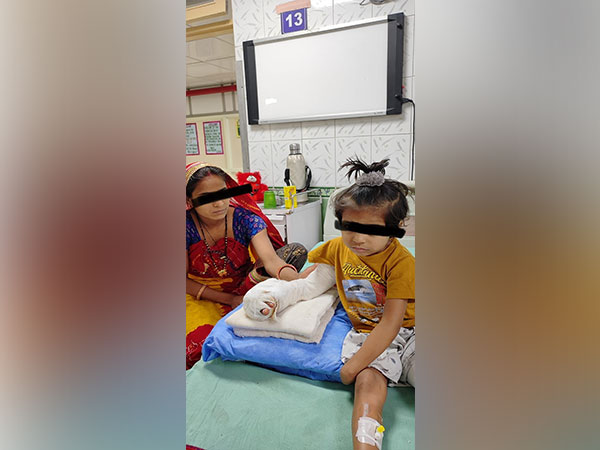 Safdurjung Hospital transplants toes to fingers