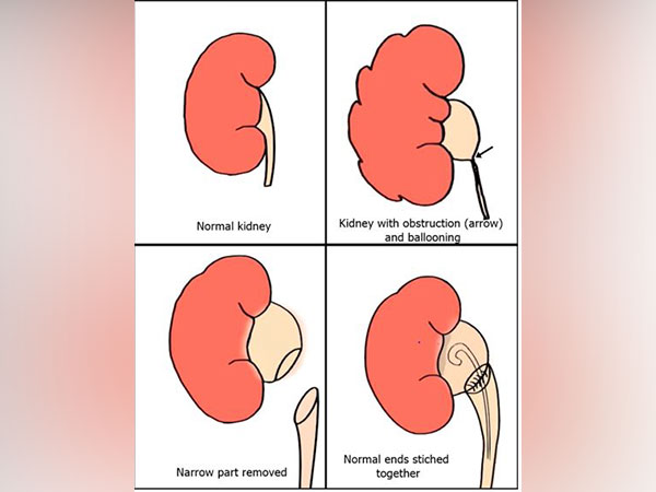 Representative Image.