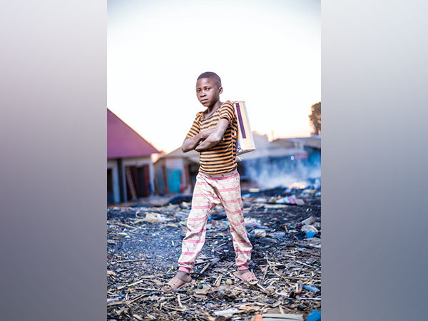 Representative image 