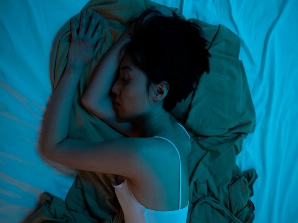 Representative image