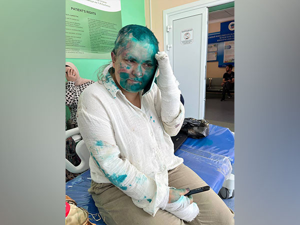 Russian journalist Yelena Milashima, who was attacked by unidentified assailants in Chechnya (Photo/Twitter)