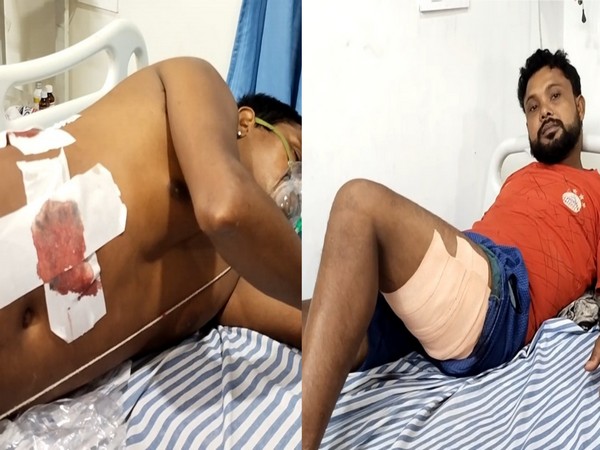  BJP workers injured in an alleged attack by TMC workers in Dinhata (Photo/ANI)