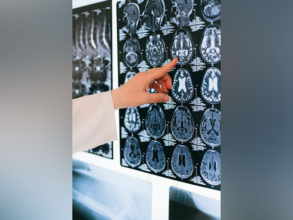 Representative image (Image source: Pexels) 