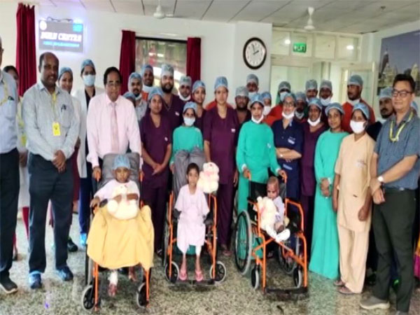 Two critically burned kids get new lease of life at Bhubaneswar AIIMS with allograft (Photo/ANI)