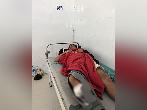 Fake document racket kingpin injured in police firing at Guwahati (Photo/ANI)