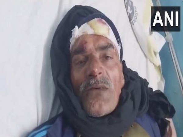 Injured Homeguard jawan (Photo/ANI)