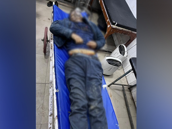 Gangster, Vinod Upadhyaya critically injured(Photo/ANI)