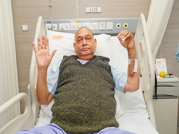 Hand transplantation was carried out on 64-year-old man with kidney transplant. (Photo: Amrita hospital)