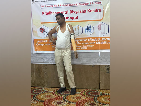 Man fitted with artificial hand (Photo/ANI)