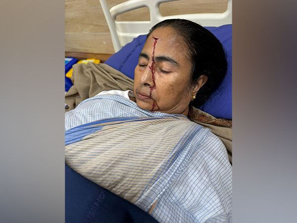 Mamata Banerjee sustained injuries on her forehead (Photo:X/AITC)