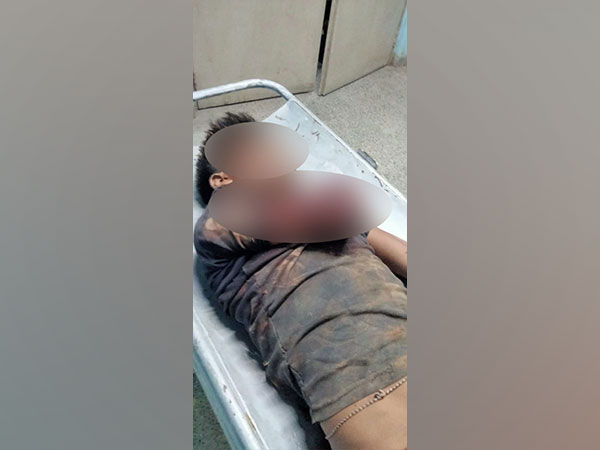 Bangladeshi smuggler shot by BSF (Photo/ANI)