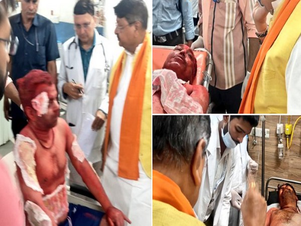 Injured undergoing treatment at Aurobindo Hospital, Indore (Photo/ Kailash Vijayvargiya's X handle)