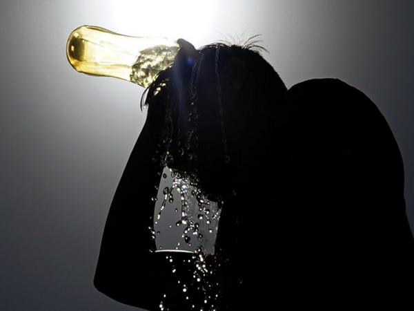 Representative Image.