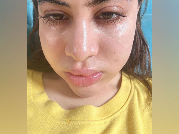 Uorfi Javed (image source: instagram/urf7i)