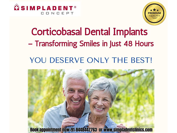 Corticobasal Dental Implants – Transforming Smiles in Just 48 Hours