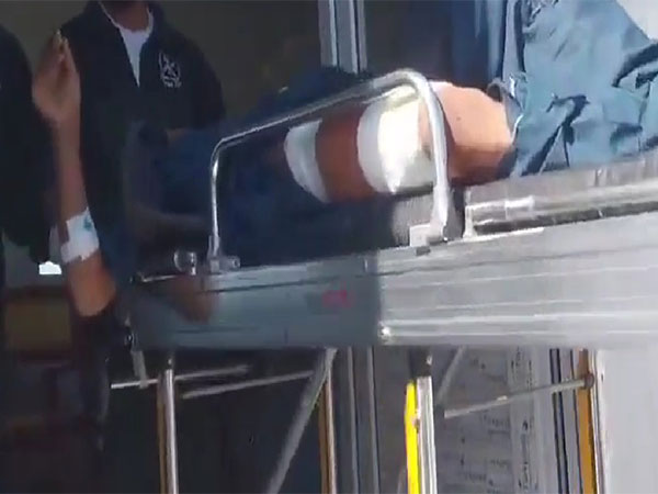 An injured Baloch Protestor (Photo/X @BalochYakjehtiC)