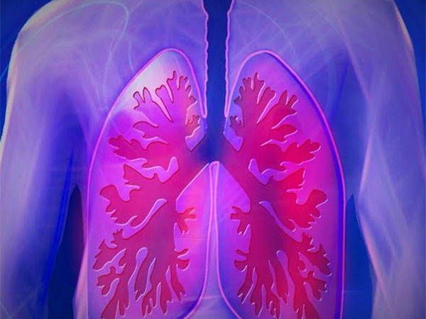 Karachi faces alarming rise in respiratory diseases  ANI News