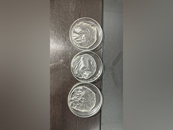 Nanoliposomes patch developed by research team of Biotechnology Department of PRSU.(Photo/ANI)