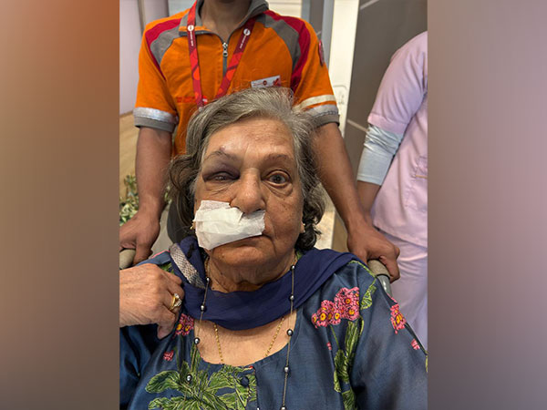 A woman claimed that her grandmother had to suffer severe injuries after Air India denied her wheelchair. (Photo/ X @Parul Kanwar)