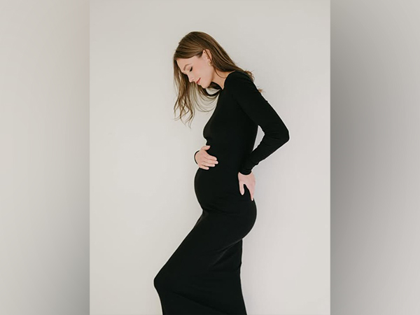 Karlie Kloss (Image source/Instagram)