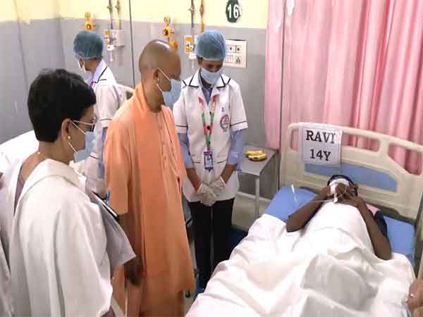 Chief Minister Yogi Adityanath meets children affected by food poisioning (Photo/ANI) 