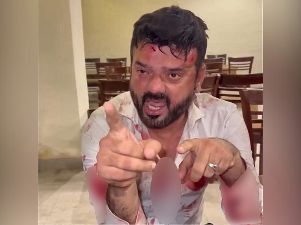 Aamir Warraich ( image source: ANI)