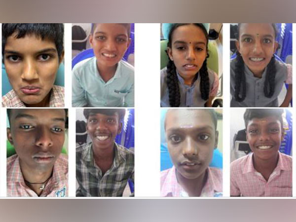 Before and After image of students following their treatment. (Photo/X@jeyaseelan_vp)