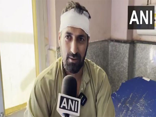  An injured local, Badruddin (Photo/ANI)