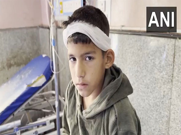 Young boy injured in Baramulla (Photo/ANI)