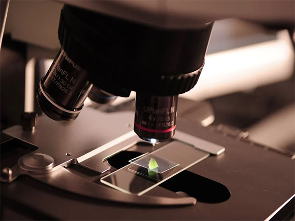 Representative Image (Photo: Pexels)